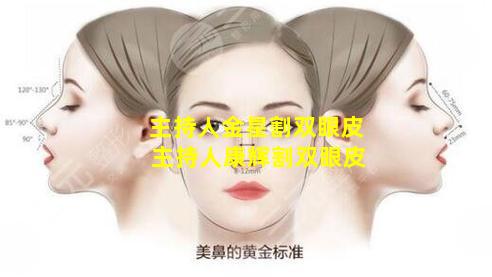 主持人金星割双眼皮 主持人康辉割双眼皮